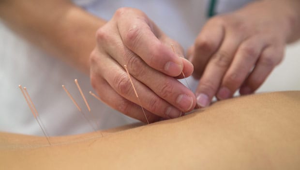 Acupuncture Treatment for Back Pain
