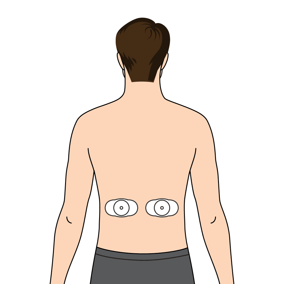 EMS P5 (Build Endurance) – pads on my lower back