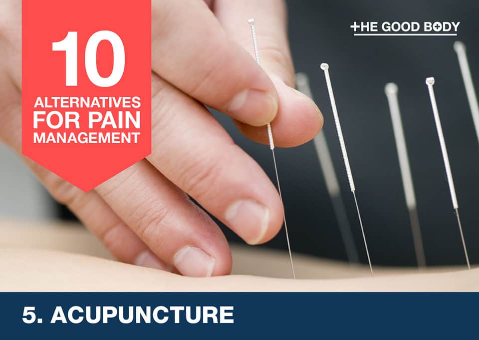 Acupuncture – an alternative for pain management