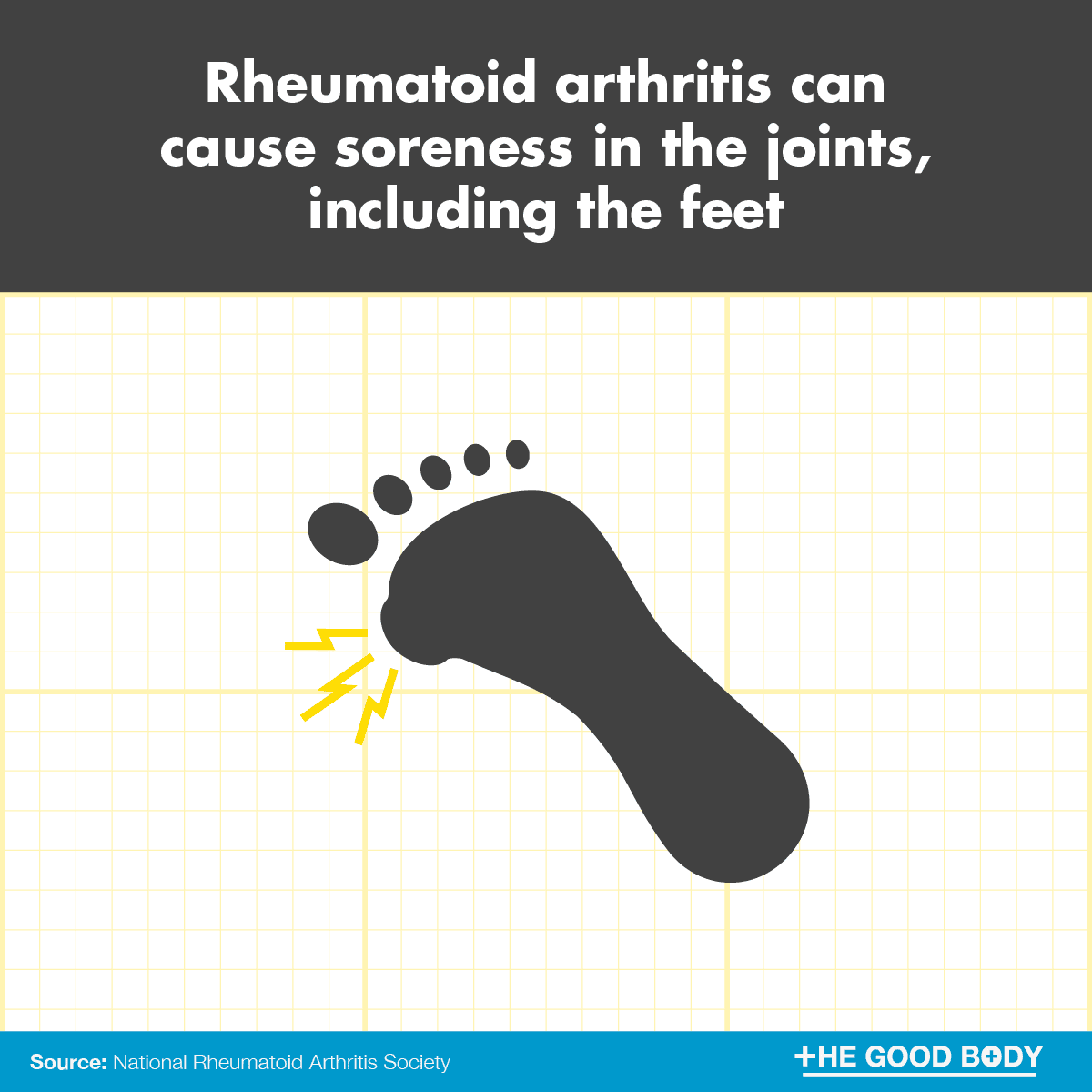 Rheumatoid arthritis can cause soreness in the joints, including the feet